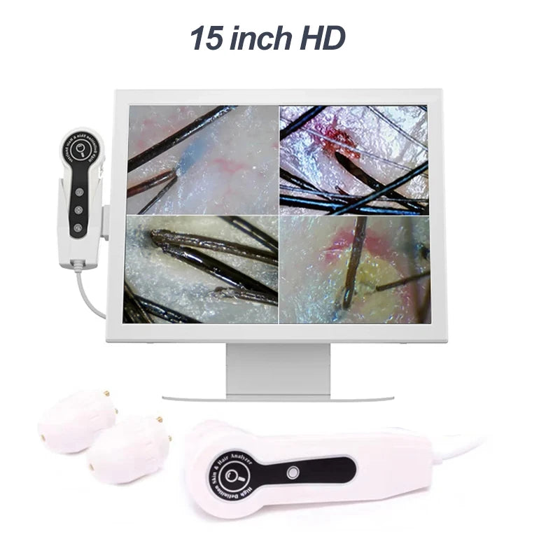 15 Inch Screen Ultra Hair Skin Analyze HD Intelligent Beauty Salon Home 50/200 Times Lens HD Scalp Hair Detector Skin Analysis