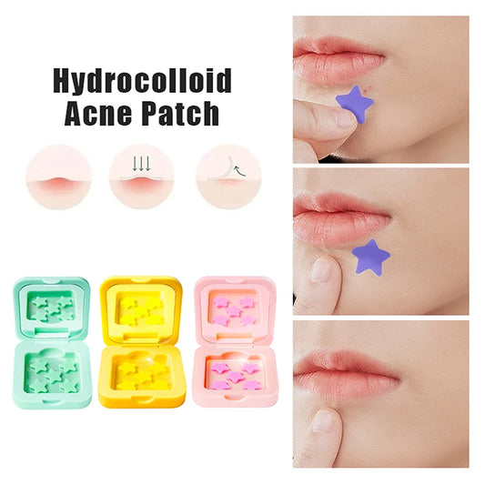 1Box 25/48 Patches Hydrocolloid Acne Patch Fade Repair Invisible Acne Removal Stickers Concealer Makeup Tool Star With Mirror