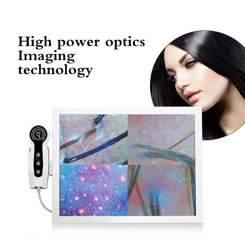 15 Inch Screen Ultra Hair Skin Analyze HD Intelligent Beauty Salon Home 50/200 Times Lens HD Scalp Hair Detector Skin Analysis